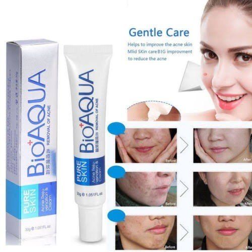 Bio aqua Acne Cream Face Skin Care Acne Anti-Wrinkle Removal Cream Spots Scar