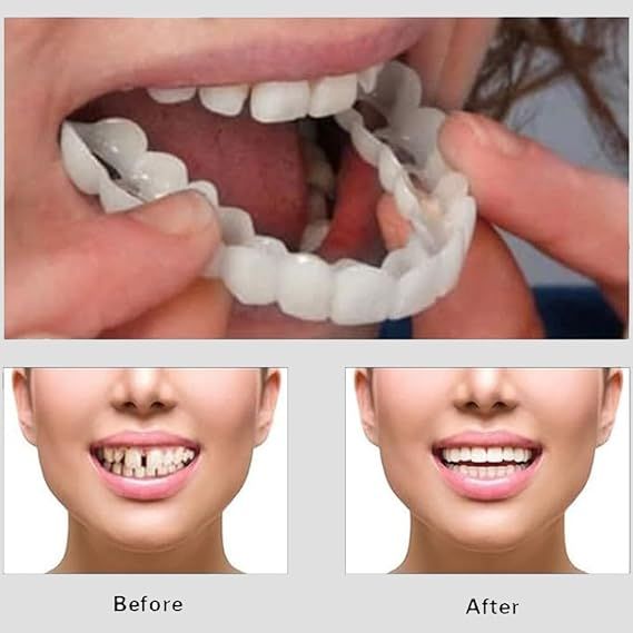 Snap On Smile Veneers Teeth For Men